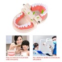 Dental Child Teeth Teaching Model Adult Teeth Gums Standard Demonstration Tool for Kids Studying