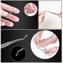 Ingrown Toenail Correction Kit Toenail Treatment Nail Glue Toenail Straightening Patch Pusher Lifter Recover Foot Correction Too