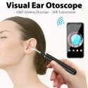 Smart Visual Ear Otoscope, 1080P Wireless Otoscope-Ear Scope Camera, USB Ear Wax removal Tools, Home Ear Inspection for Kids and