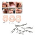 12Pcs Ingrown Toenail Correction Wire Fixer Ingrown Toe Nail Corrector Pedicure Treatment Foot Care Tool