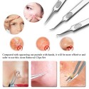 3PCS Stainless Steel Acne Needle Blackhead Removal Clip Whitehead Removal Needle Blemish Remover Tweezers Face Care Beauty Repai